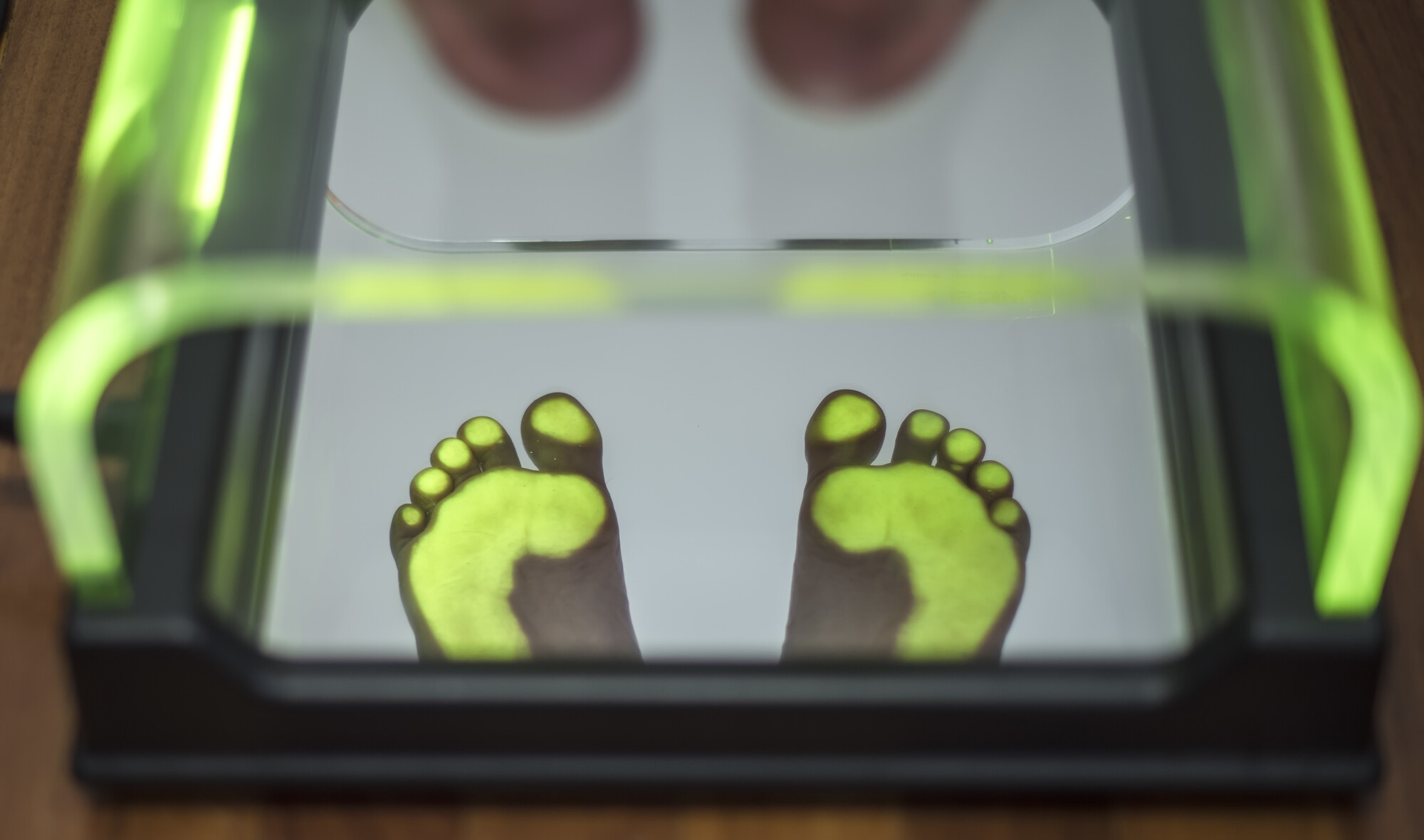 Due piedi nudi appoggiati su un podoscopio con bordi verdi luminosi, le zone di carico evidenziate in giallo